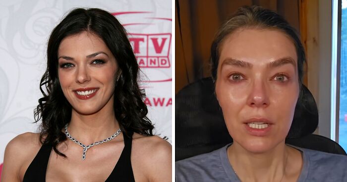 “Humiliating”: ANTM Star Says She’s Too Ashamed To Admit She Was Once On Television