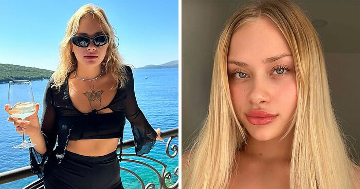 New Details Emerge After Model Is Found On Roadside In Dubai With Spine And Limbs Broken