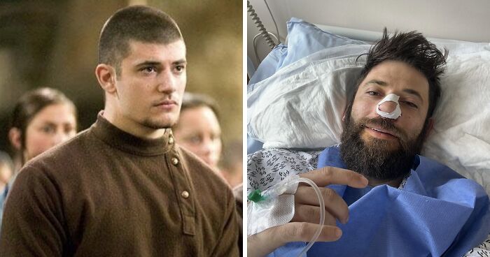 ‘Harry Potter’ Star Who Played Viktor Krum Rushed To Hospital For Emergency Surgery