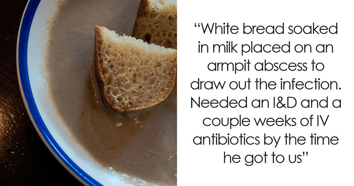 “They Put Duct Tape On Blistered Skin”: 50 Times Doctors Saved Patients From Their DIY Treatments