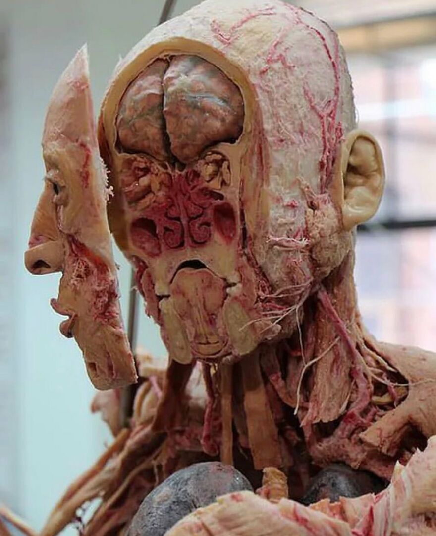 Anatomical medical display showing facial muscles, brain, and internal structures in a detailed and bizarre medical image.