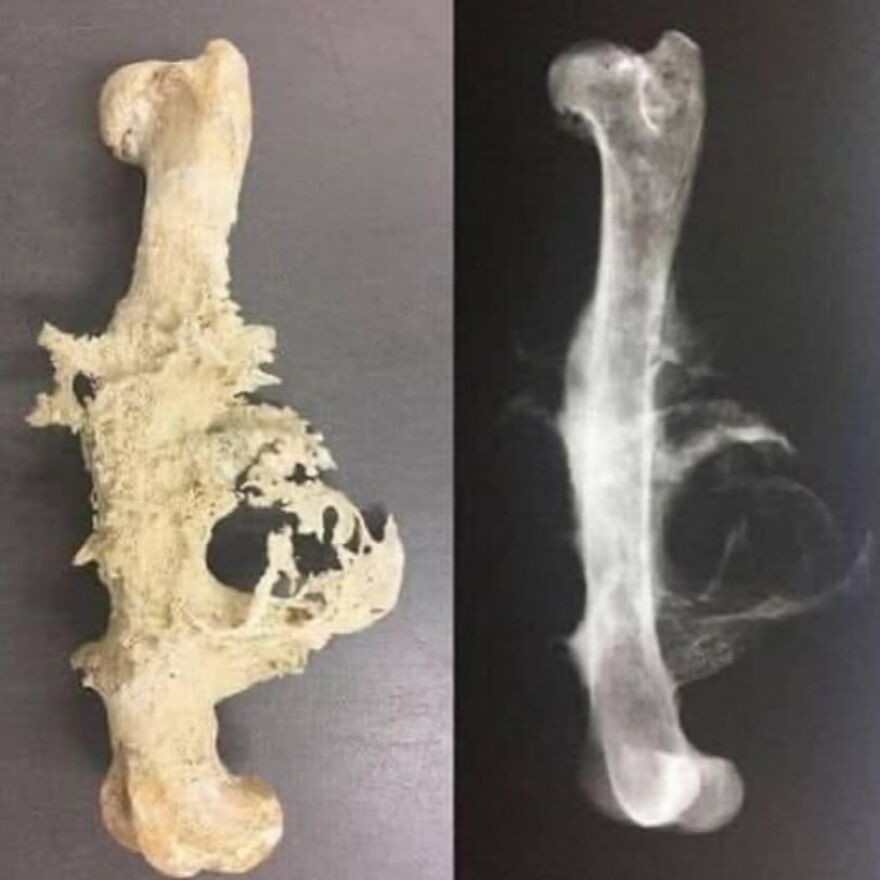 Severely damaged and deformed bone alongside an X-ray showing bizarre medical abnormalities from eerie medical pics.