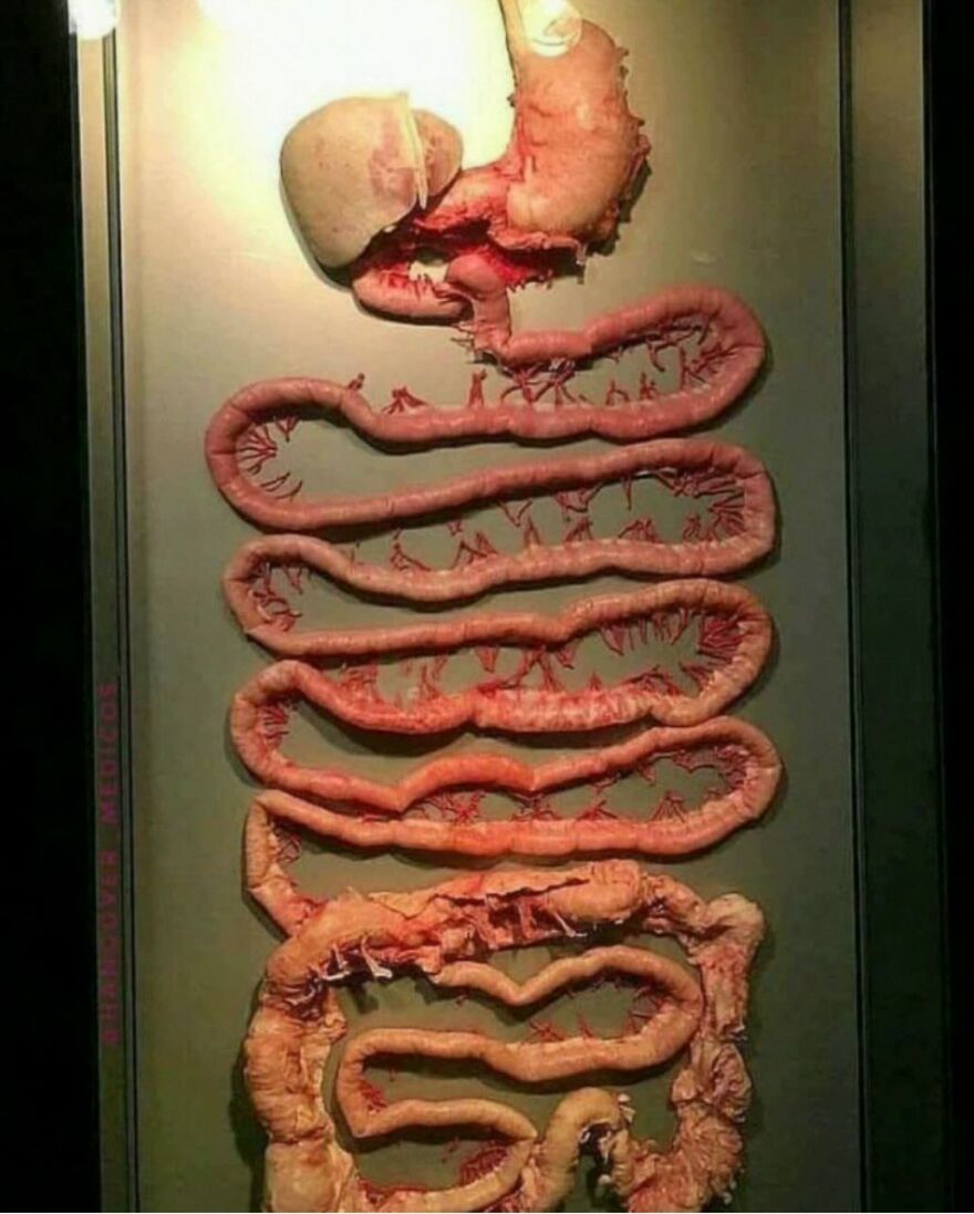 Preserved human digestive system displayed with bizarre medical details and eerie anatomical features under bright lighting.