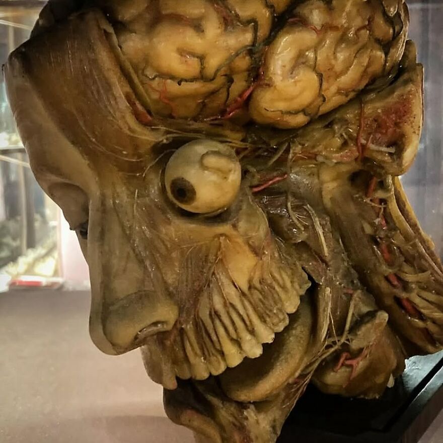 Preserved human head and brain cross-section displaying detailed anatomy in a bizarre medical pic from IG account.