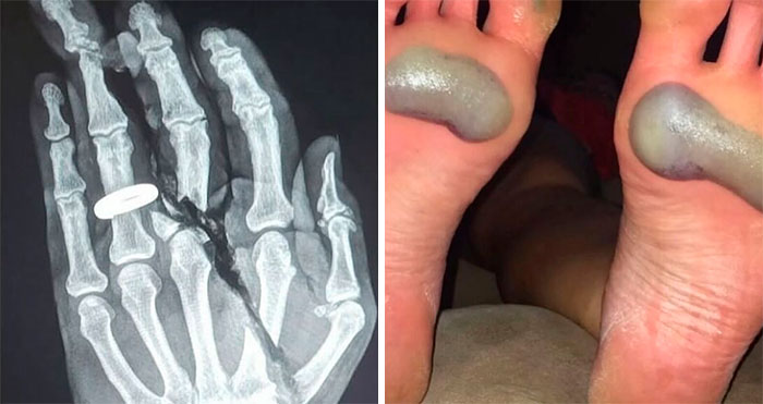 50 Medical Pics That Prove The Body Keeps The Score, And Sometimes It’s Absolutely Terrifying