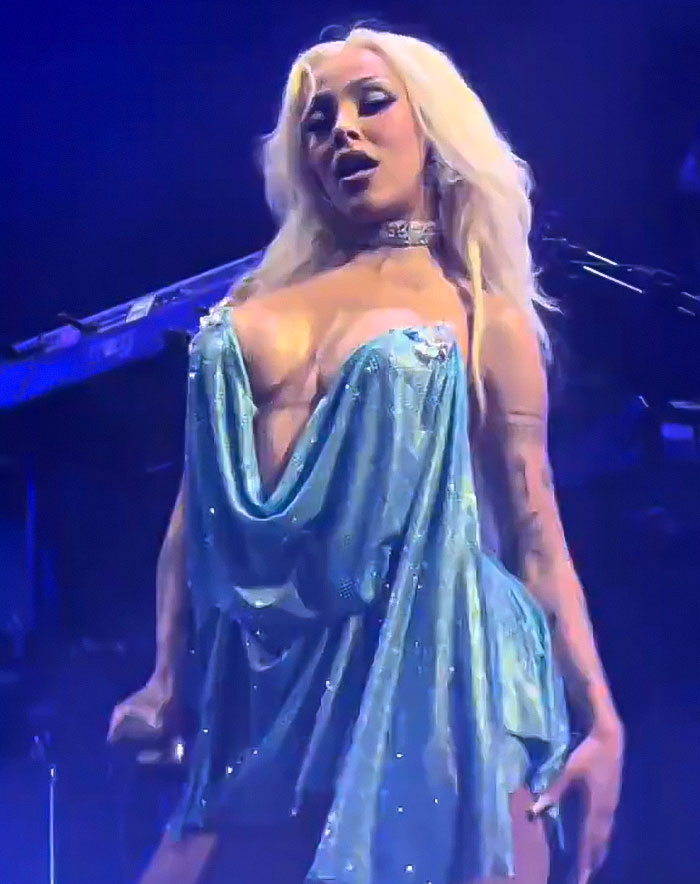 Doja Cat performing in a sparkling blue dress on stage, highlighting a plastic surgery mishap during the event. Doja Cat performing in a sparkling blue dress on stage, highlighting a plastic surgery mishap during the event.