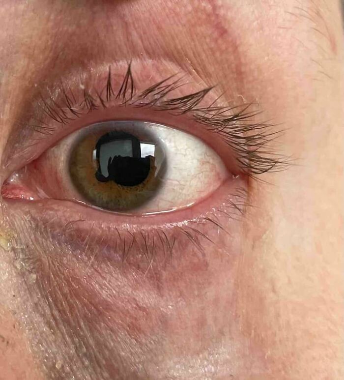 Close-up photo of a human eye showing detailed skin texture and eyelashes for human body fascination.