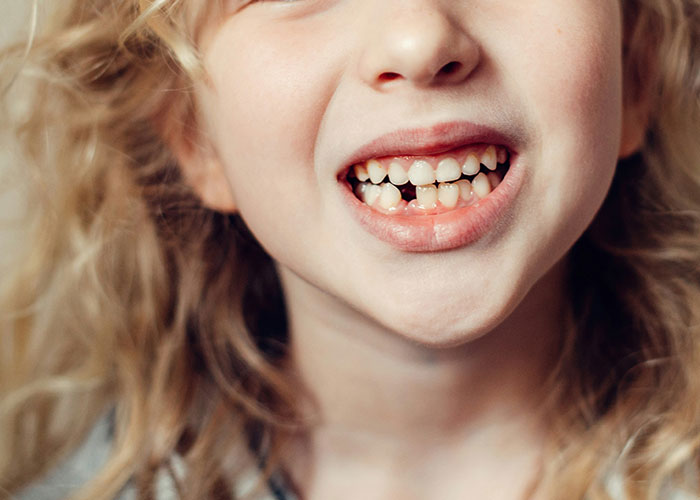 Close-up of a child with messy teeth smiling, illustrating parents’ experiences with kids’ worst public behavior moments.