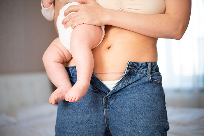 Close-up of a woman holding a baby, showing a C-section scar and loose jeans after pregnancy and birth recovery.