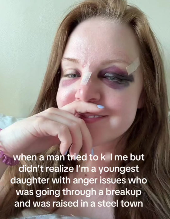 Woman with visible bruises and bandages sharing her survival story highlighting misogyny and gender-based violence awareness.