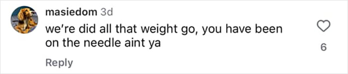 Comment questioning weight loss and suggesting use of a needle, related to Kelly Osbourne's stunning transformation and plastic surgery rumors.