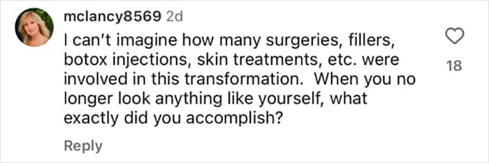 Comment questioning the number of surgeries, fillers, botox injections, and skin treatments involved in Kelly Osbourne's transformation.