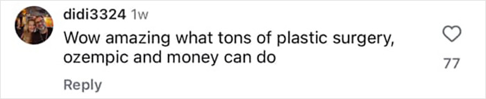 Comment mentioning Kelly Osbourne's stunning transformation, plastic surgery, and Ozempic rumors in social media post.