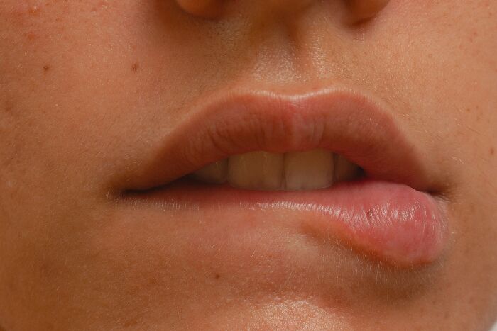 Close-up of a person biting their lip, illustrating childhood habits that are attention-seeking red flags.