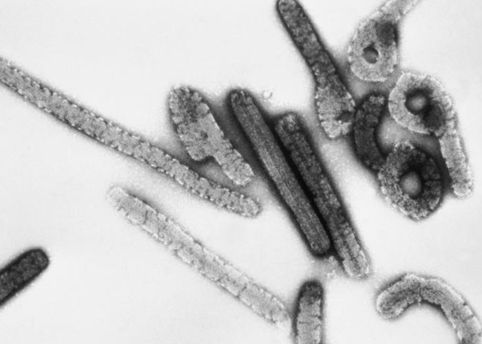 Microscopic view of virus particles representing historical events and things people research from the past.