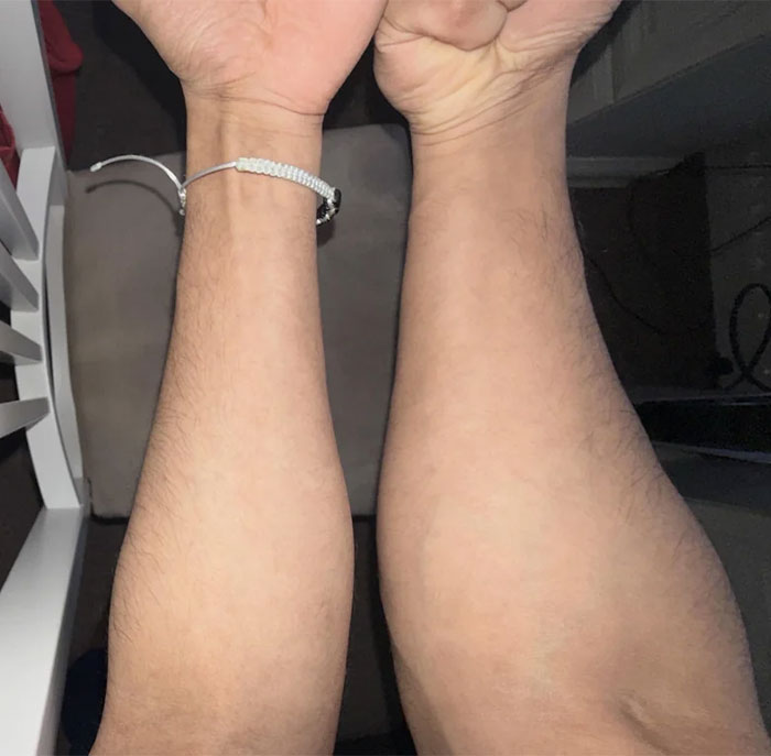 Two forearms shown side by side highlighting differences in skin tone and hair, fascinating pictures for curious minds.