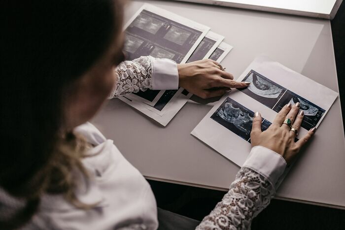 Doctor examining unusual ultrasound images on a desk, showcasing interesting and weird finds shared by medical professionals.