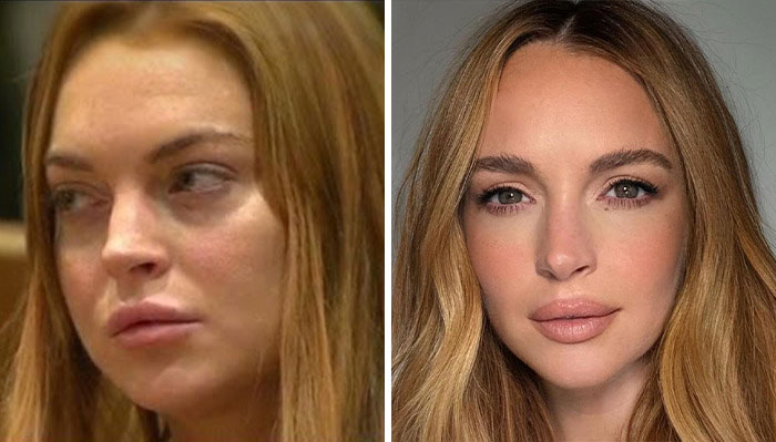 Lindsay Lohan in side-by-side images showing her look transformation and missing freckles in a new ad campaign.