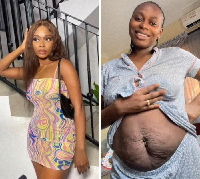 Before and after photos of moms showing changes in their bodies and losing their spark after giving birth.