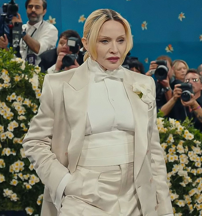 66YO Madonna Brings Back Natural Look At Met Gala 2025 After Concerning Plump Cheeks And Pout