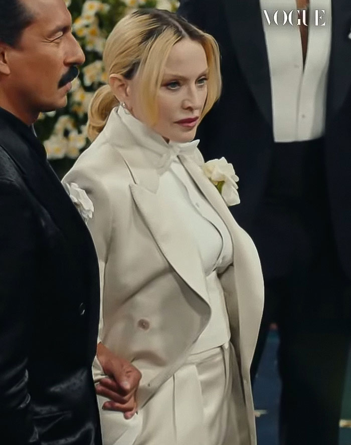 66YO Madonna Brings Back Natural Look At Met Gala 2025 After Concerning Plump Cheeks And Pout