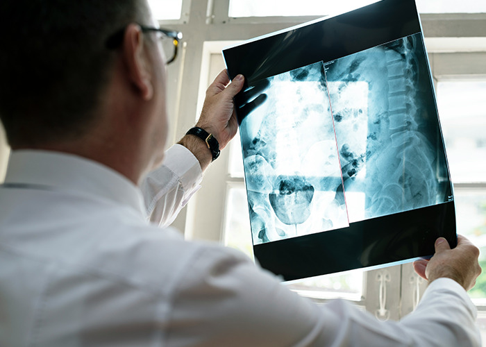 Medical worker examining an X-ray with a focused expression while reviewing an unbelievable medical image.