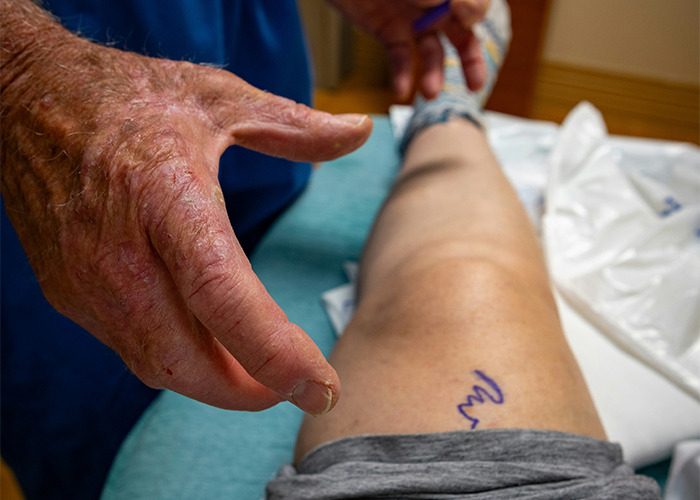 Close-up of a medical worker preparing a patient's leg marked for surgery, demonstrating careful attention in a clinical setting.