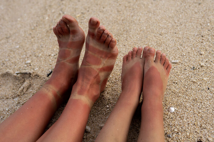 Two pairs of feet resting on sand, showing unique tan lines and sun exposure as a distinct body feature.