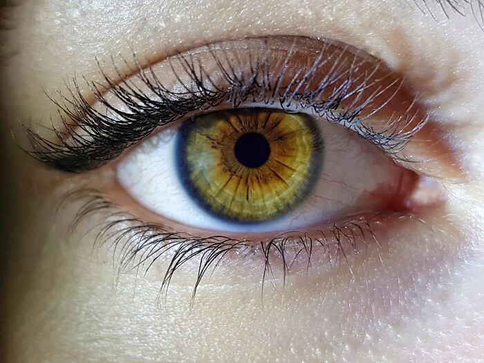Close-up of a unique hazel eye showcasing distinct body features discussed by netizens online.