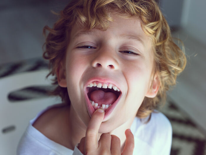 Child with curly hair showing unique body feature by pointing at teeth, illustrating diverse body features discussed by netizens.