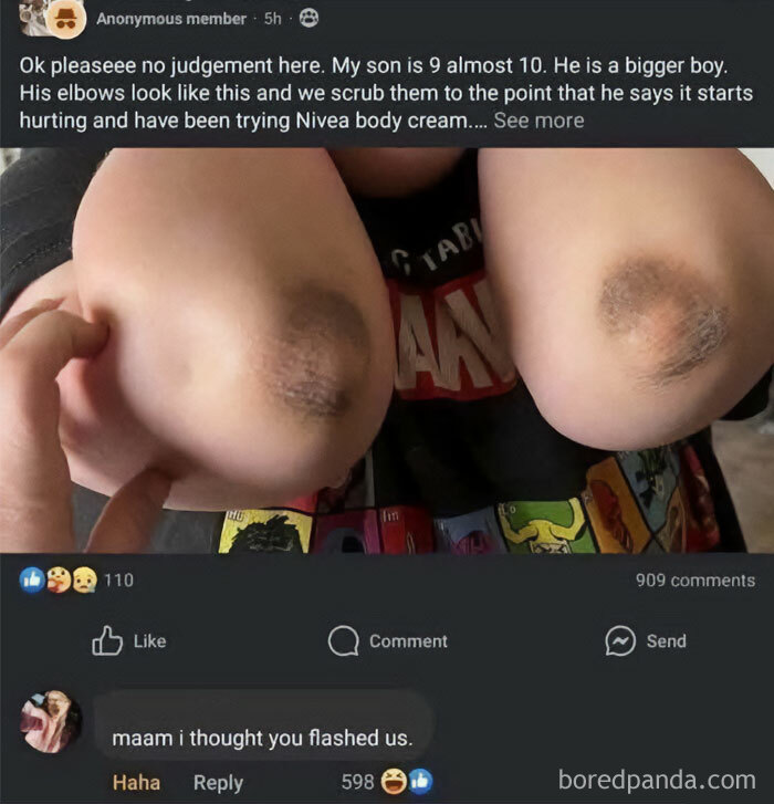 Close-up of a child's bruised elbows shared in a mocking posts jokes memes screenshot on social media.