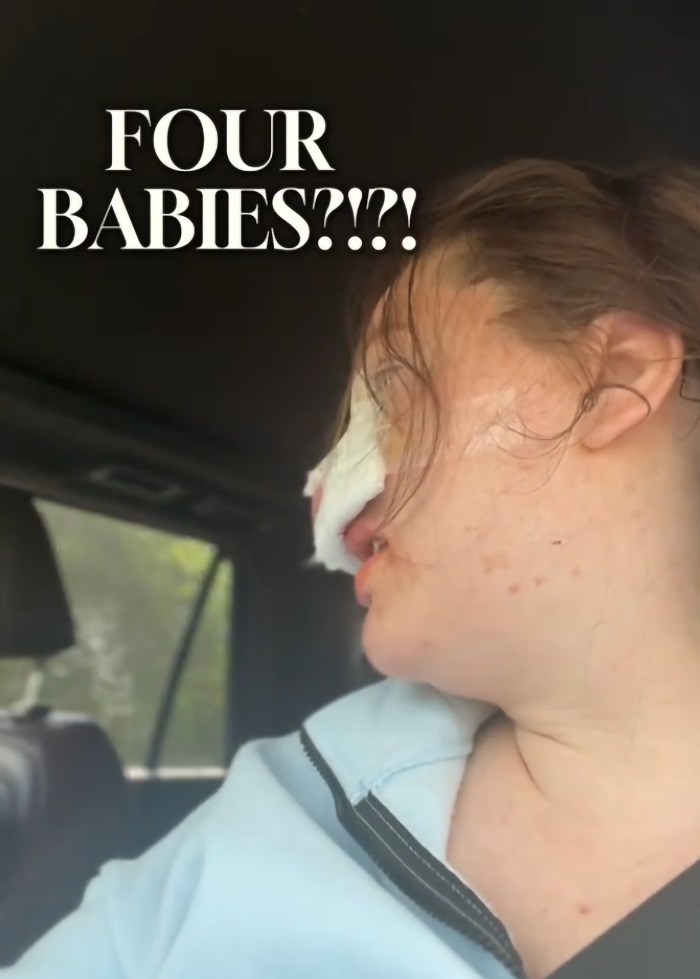 Mom wakes from surgery looking shocked and unprepared after giving birth to multiples in a car seat.