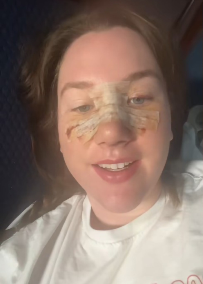 Young mom recovering from surgery with facial bandages, surprised by how many kids she gave birth to.