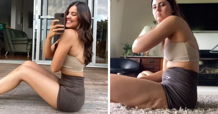 40 Women Tired Of “Skinny-Tok” Show What Unedited Bodies Look Like