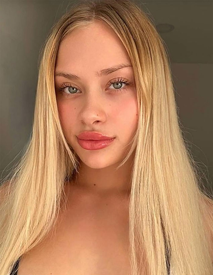 Young model with long blonde hair and clear skin, related to news about a roadside accident with spine and limbs broken in Dubai.