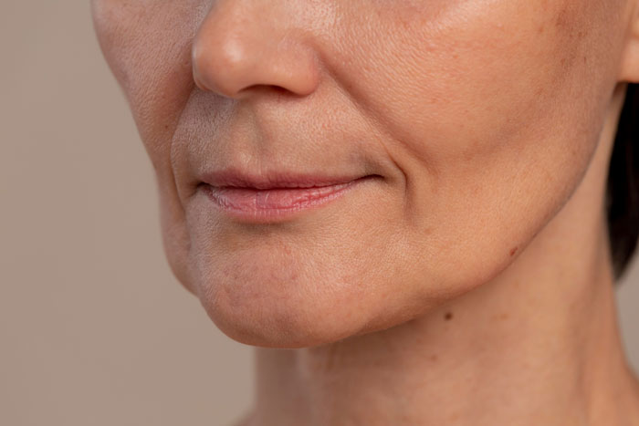 Close-up of a mature woman’s lower face showing natural skin texture and subtle smile, related to Ozempic diet medicine. Close-up of a mature woman’s lower face showing natural skin texture and subtle smile, related to Ozempic diet medicine.