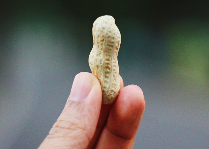 Hand holding a single peanut showing how a patient’s lie about allergies could nearly cost their life risks.