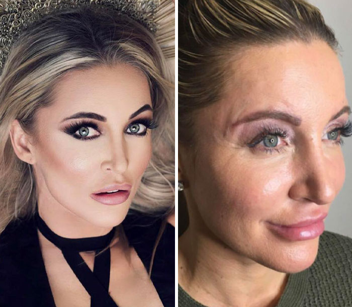 Side-by-side photos of an influencer before and after heavy editing on Instagram posts revealing natural appearance.