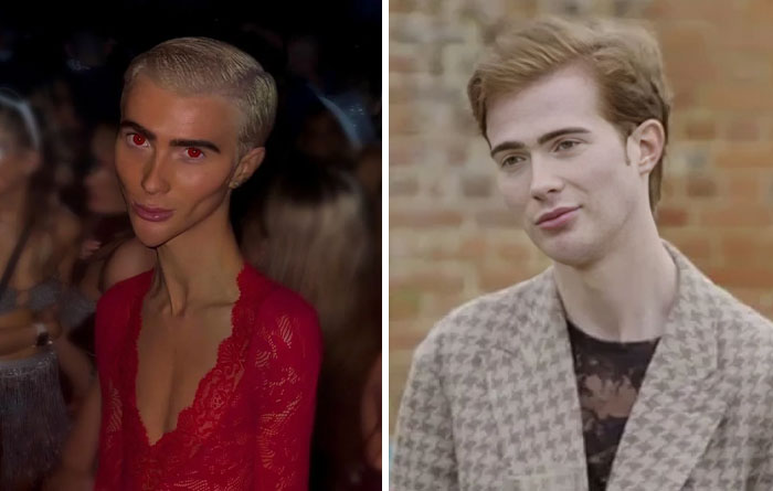 Side-by-side photos showing influencer before and after heavy editing on Instagram posts with altered facial features.