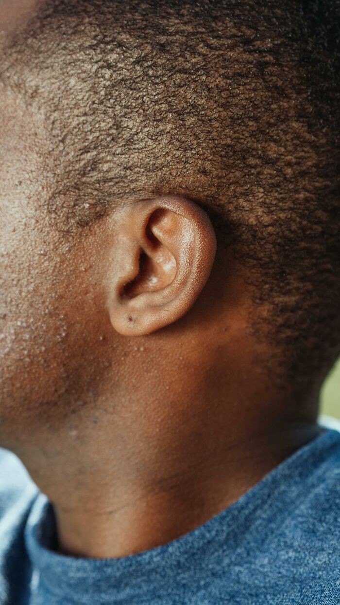 Close-up of a person's ear and side of the head, highlighting tinnitus-related concerns on a daily basis.