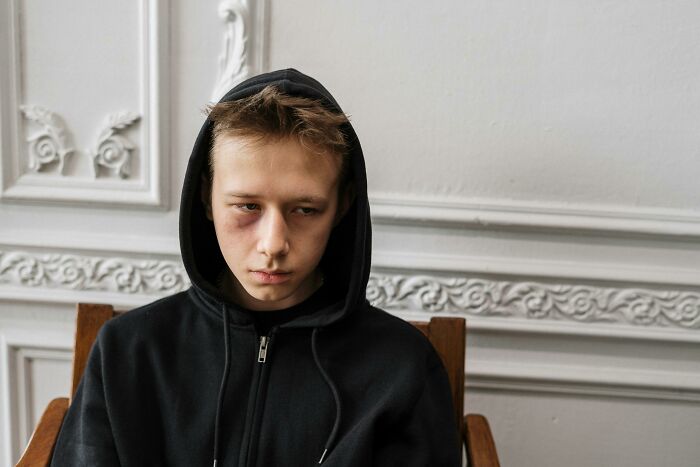 Young man with a black eye wearing a black hoodie sitting against a white ornate wall, reflecting on life blunders.