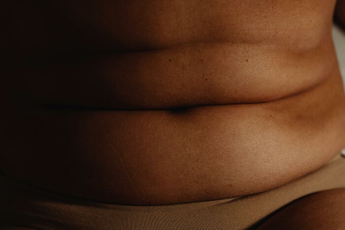 Close-up of body changes showing skin folds and texture as signs of getting older and natural aging process.