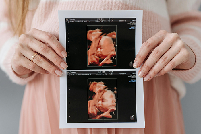 Woman holding ultrasound images at a baby shower celebrating pregnancy after fertility struggles with her best friend. Woman holding ultrasound images at a baby shower celebrating pregnancy after fertility struggles with her best friend.