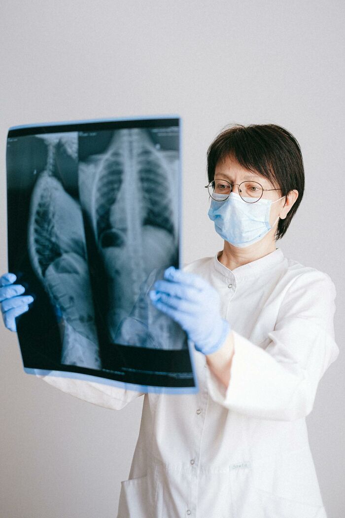 Doctor wearing mask and gloves examining chest X-ray as part of interesting and weird finds in medical field.