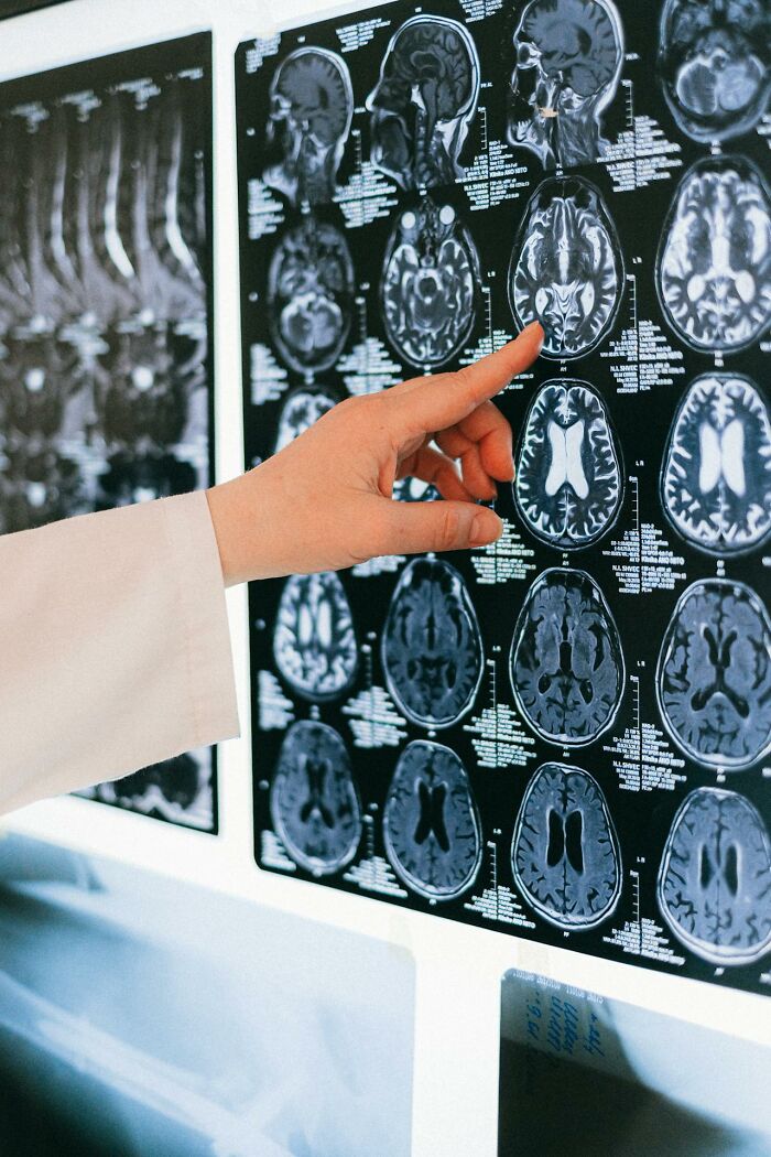 Doctor pointing at brain scans on a lightbox showing detailed medical images related to unusual finds by doctors and morticians.