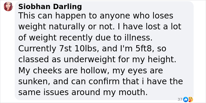 User comment discussing personal experience with weight loss and symptoms similar to Ozempic mouth side effect. User comment discussing personal experience with weight loss and symptoms similar to Ozempic mouth side effect.