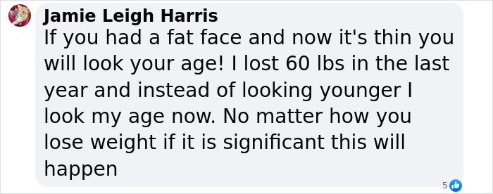 Facebook comment by Jamie Leigh Harris describing changes in appearance after significant weight loss, mentioning Ozempic mouth side effect. Facebook comment by Jamie Leigh Harris describing changes in appearance after significant weight loss, mentioning Ozempic mouth side effect.