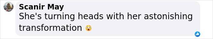 Christina Aguilera’s latest appearance sparks Ozempic and surgery rumors, showing her striking new look in public. Christina Aguilera’s latest appearance sparks Ozempic and surgery rumors, showing her striking new look in public.