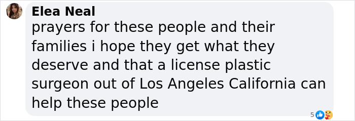 Comment expressing hopes that a license plastic surgeon in Los Angeles can help women disfigured after cosmetic procedures.