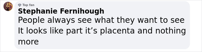 Comment about "Hand of God" appearing in ultrasound, with user expressing skepticism, mentioning placenta.